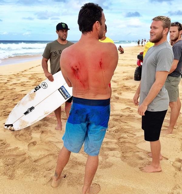 Parko se acidenta e está fora do Vans World Cup